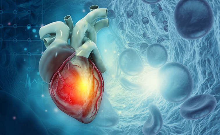 Chronic Coronary Syndromes