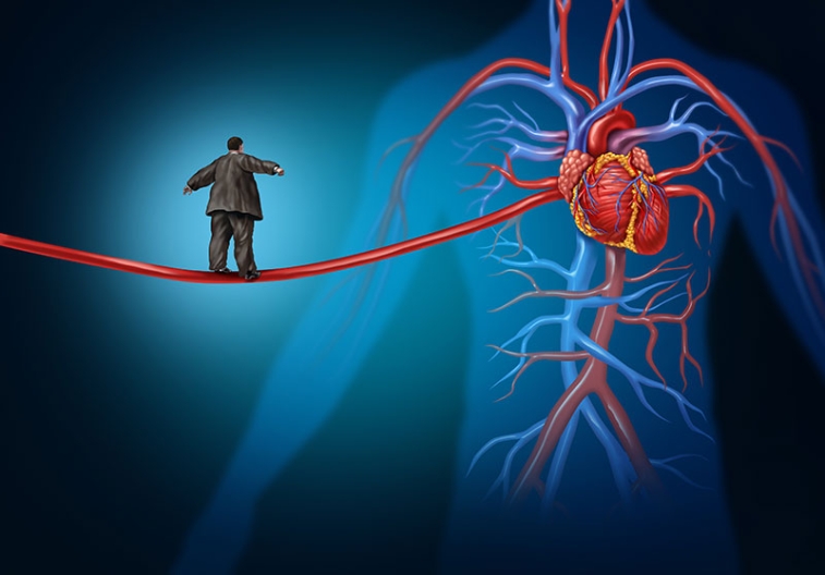 Obesity and Cardiovascular Disease