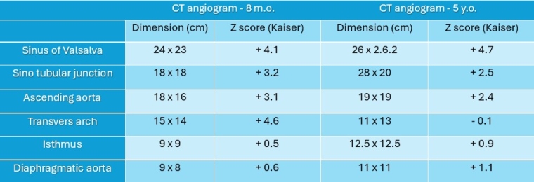 Table 1. Comparison between dimension of the aorta at two CT angiogram performed 4 years apart.