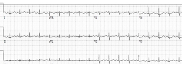 Figure 3A.jpg