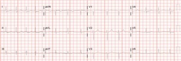 Figure 3B.jpg