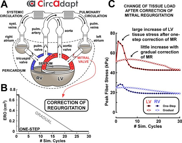 Original Research Paper Artificial Intelligence And Advanced Computer Modelling In Transcatheter Interventions For Structural Heart Disease Implications For Clinical Practice