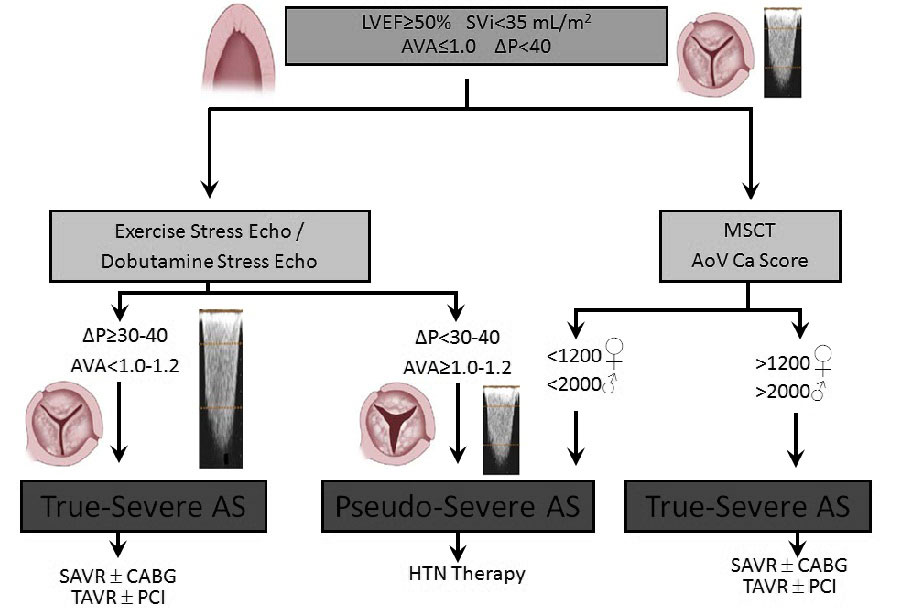 Low Flow Low Gradient Aortic Stenosis Review Lynnette Knott   3.19 Fig2 